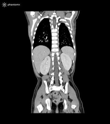 CT Imaging Simulators