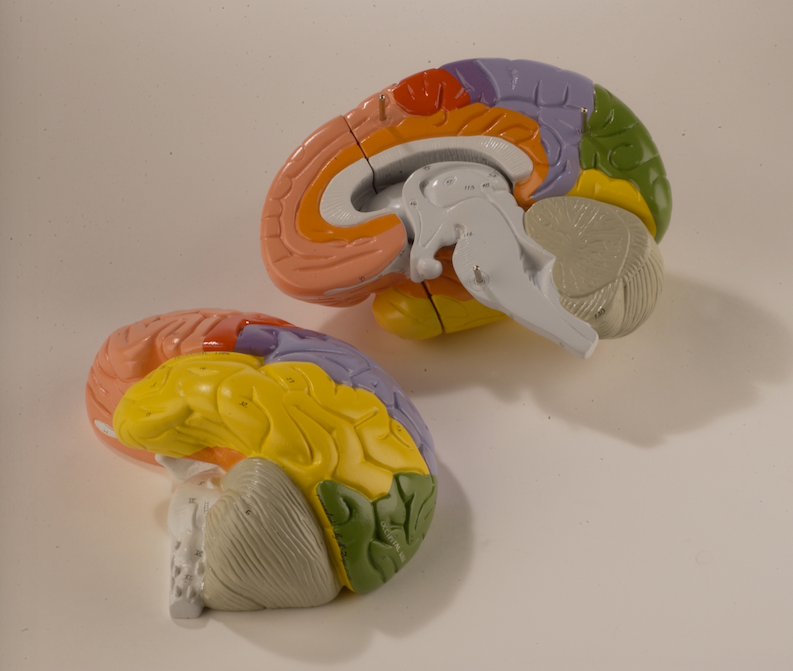 0171-00 Giant Regional Brain