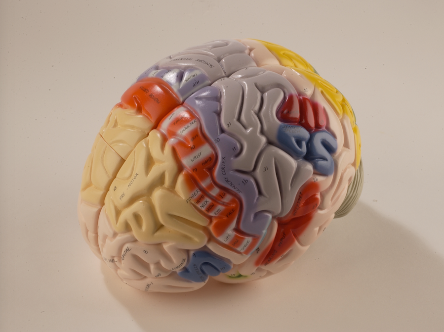 0172-00 Giant Functional Center Brain
