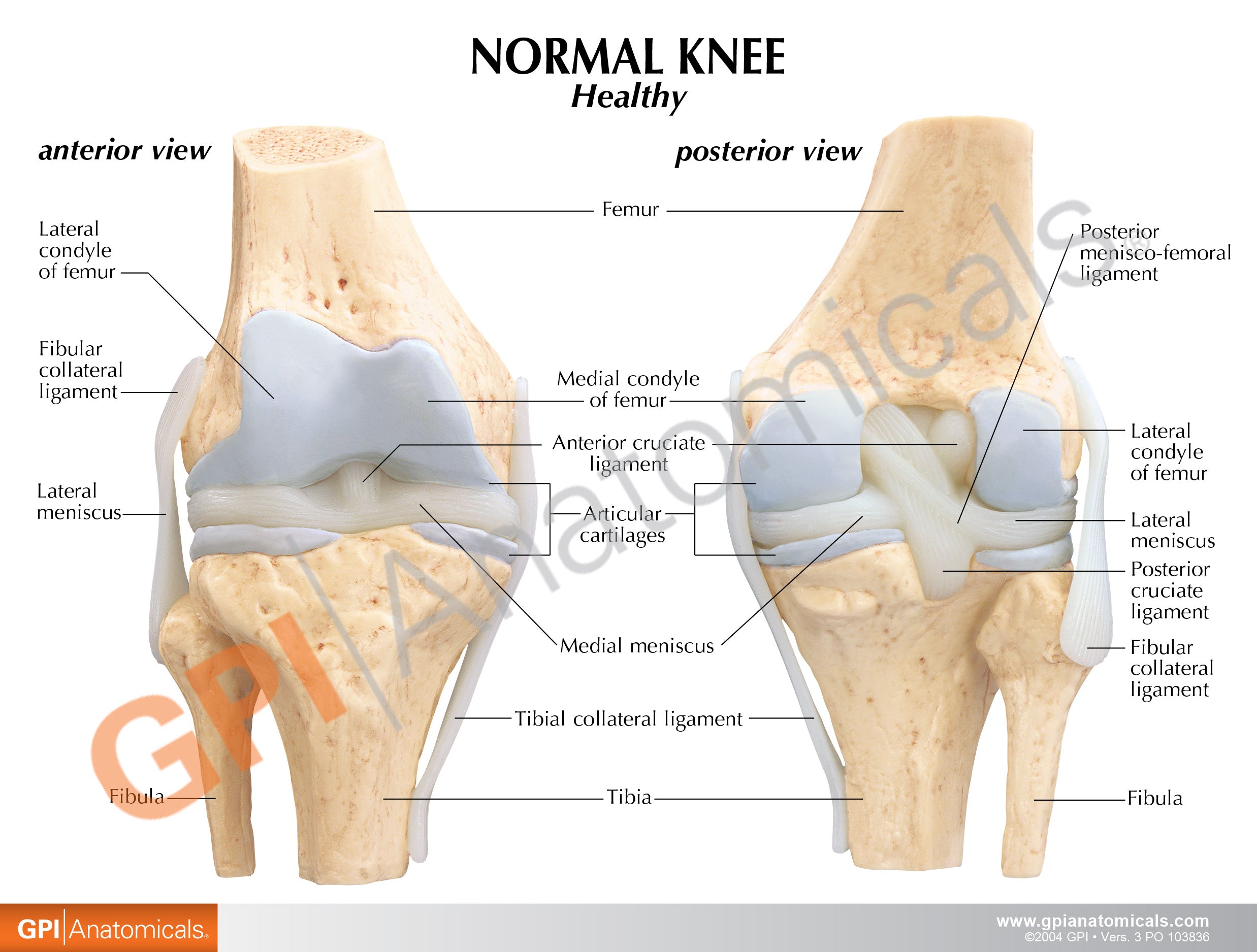 4-Stage Osteoarthritis Knee Set