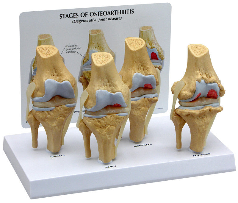 1100_4stage_knee__88798.1589753330.1280.1280.jpg