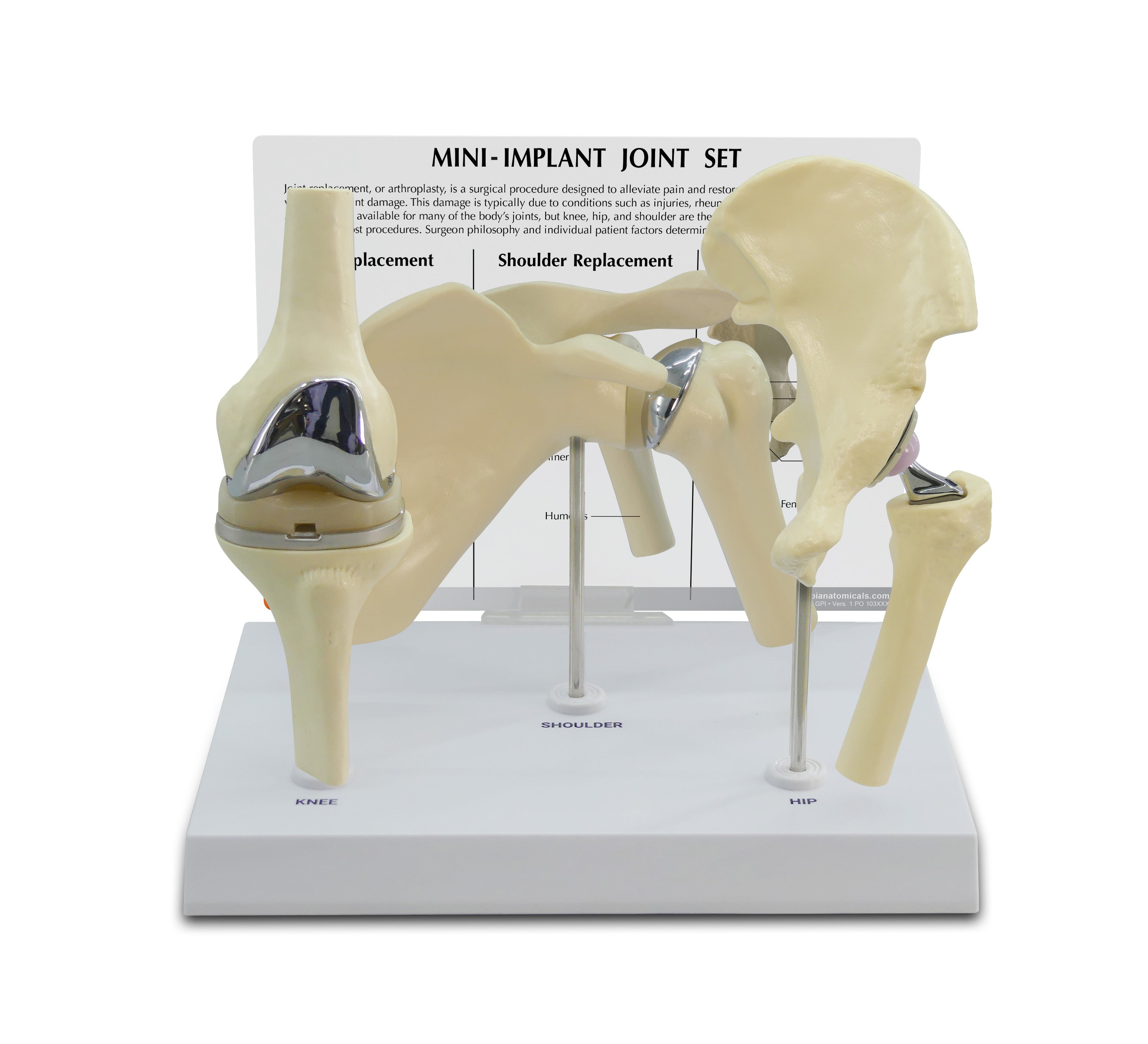 Mini-Implant Joint Set (NEW! Model)