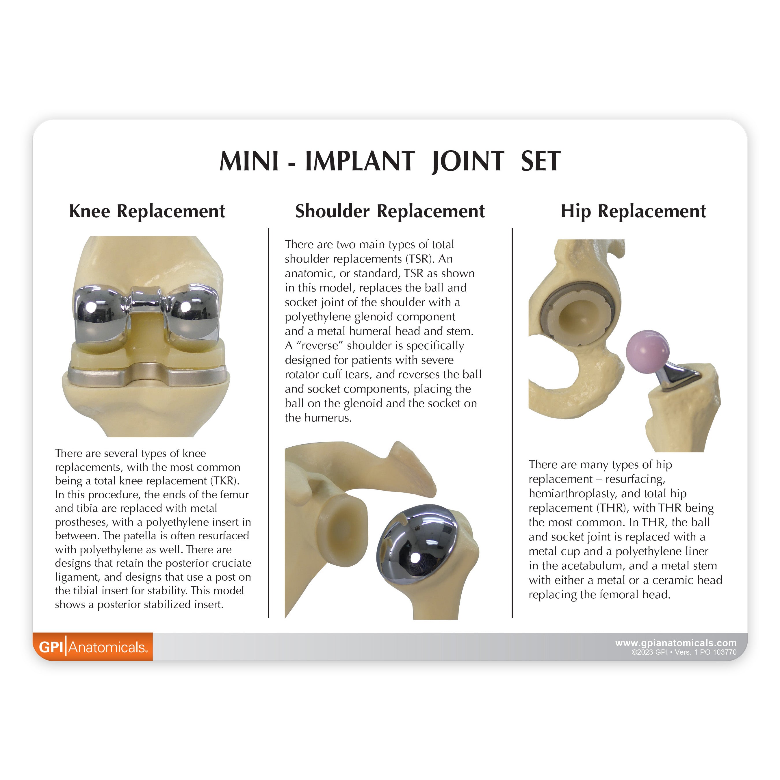 Mini-Implant Joint Set (NEW! Model)