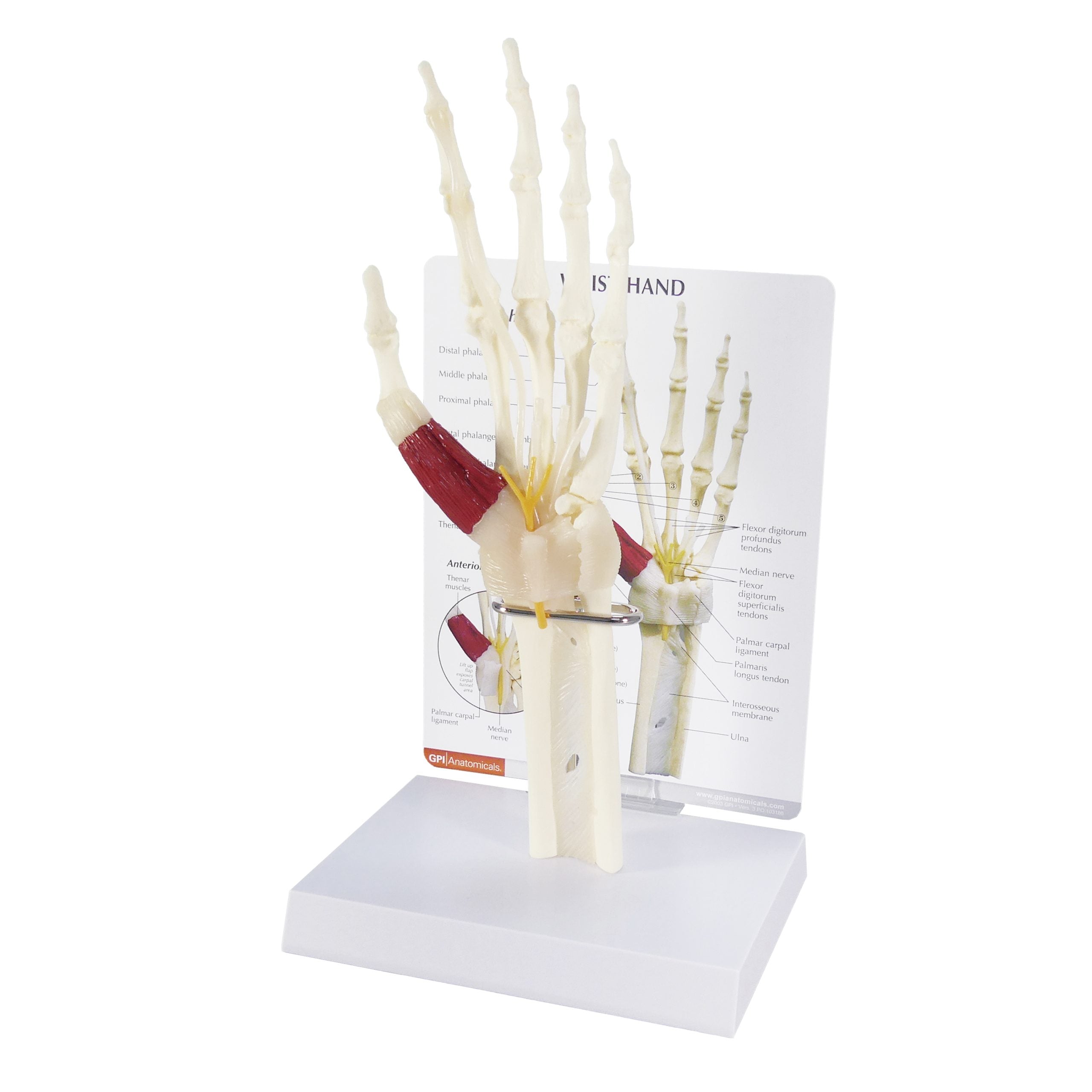 Hand/Wrist (Carpal Tunnel Syndrome)