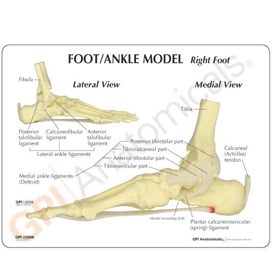 Foot/Ankle (Plantar Fasciitis)
