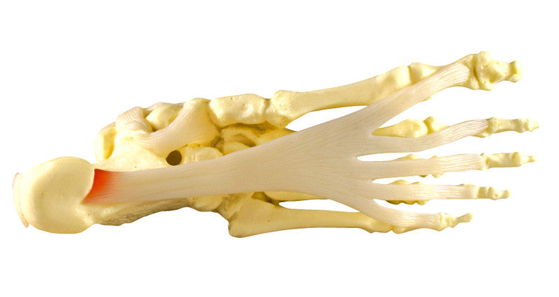 1980_foot_ankle_ins-plantar__86824.1589753090.1280.1280.jpg