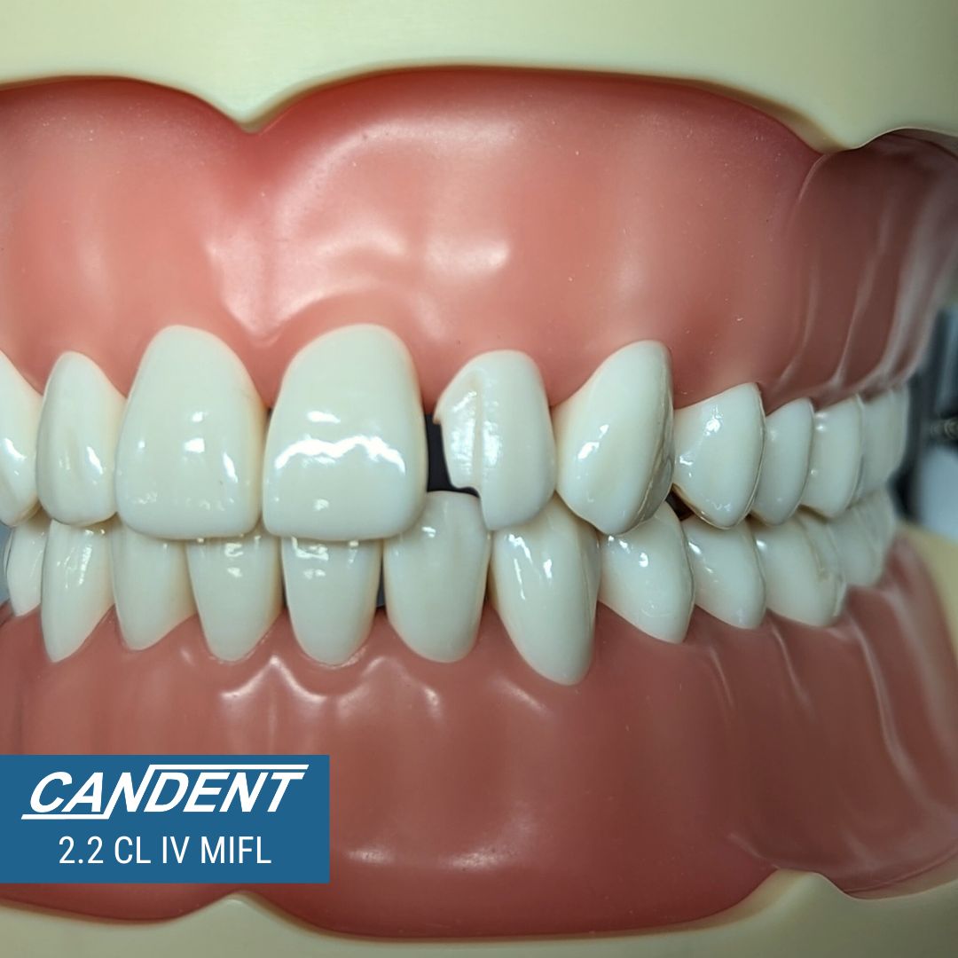 700 Series Practice Preps