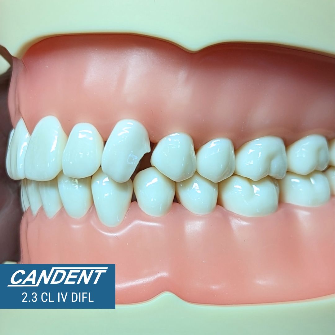 700 Series Practice Preps