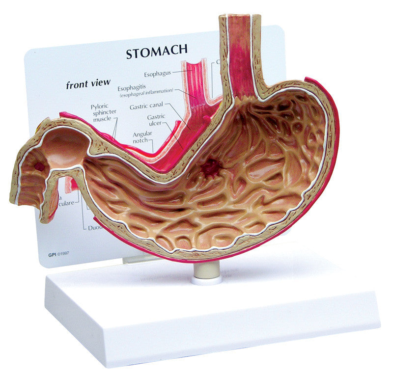 2000_stomach__04741.1589753161.1280.1280.jpg
