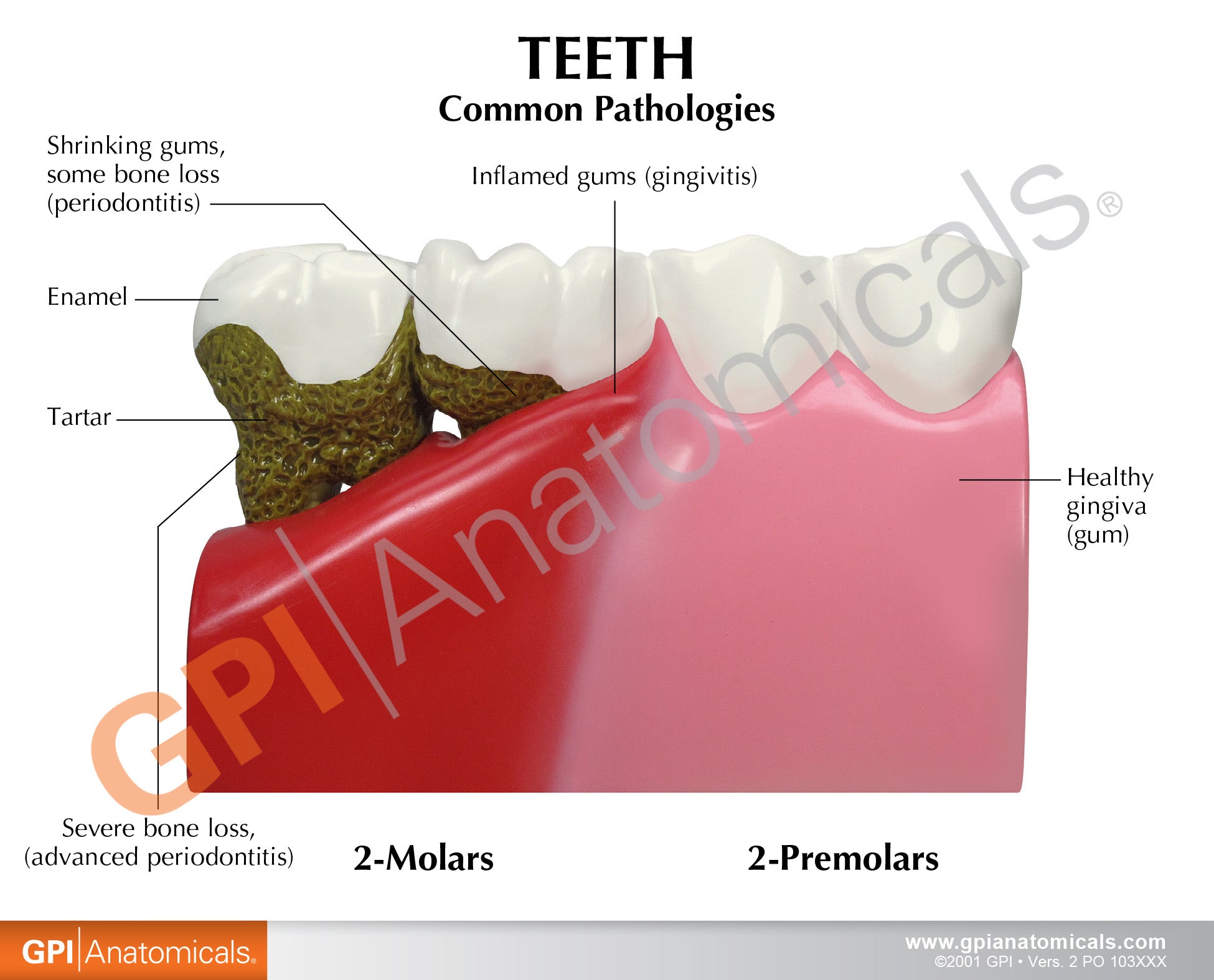 Teeth (Healthy/Pathologies)