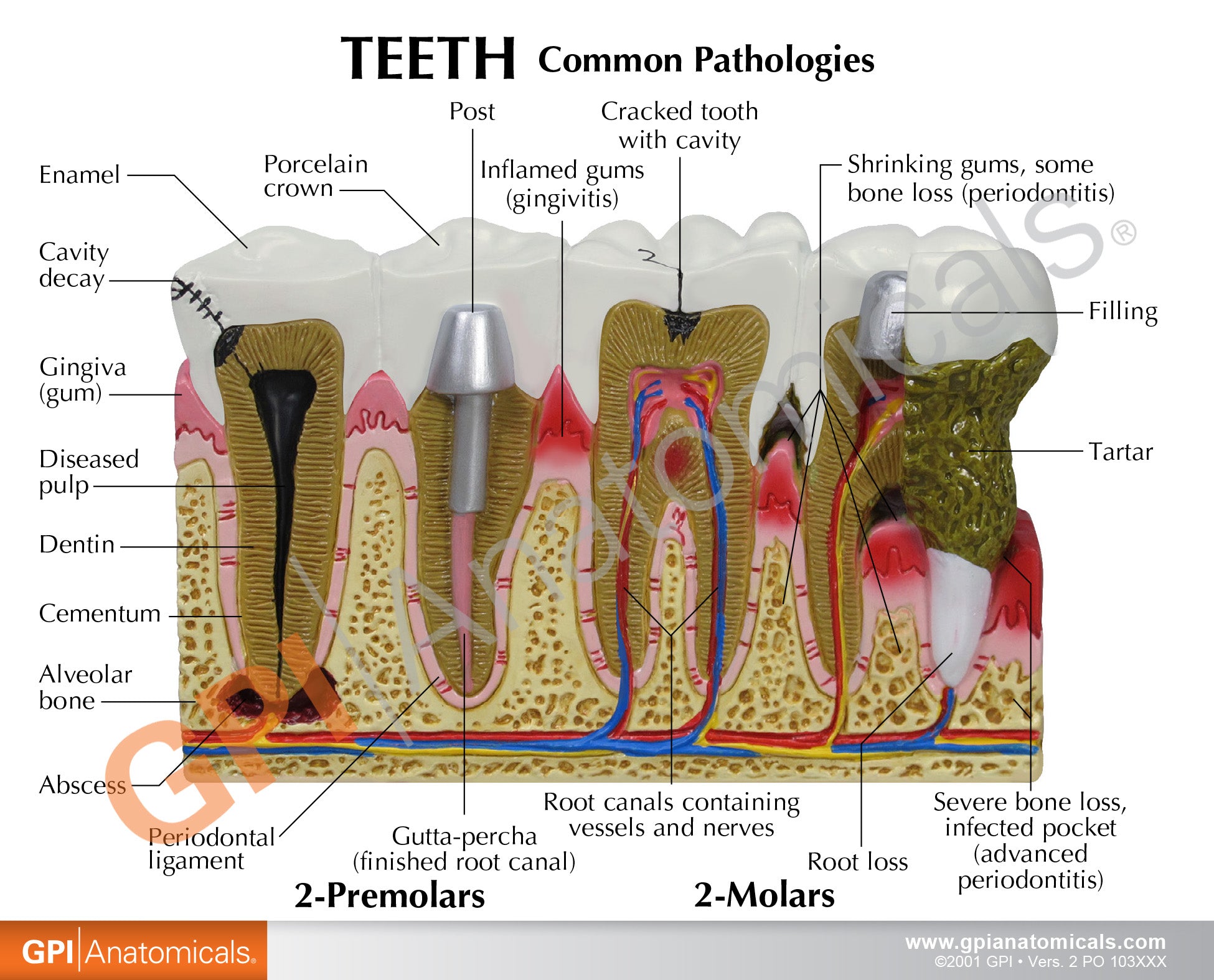 Teeth (Healthy/Pathologies)