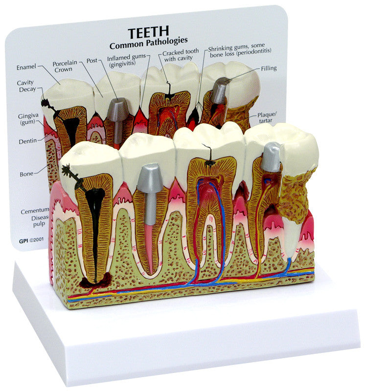 2860_teeth__06062.1589753250.1280.1280.jpg