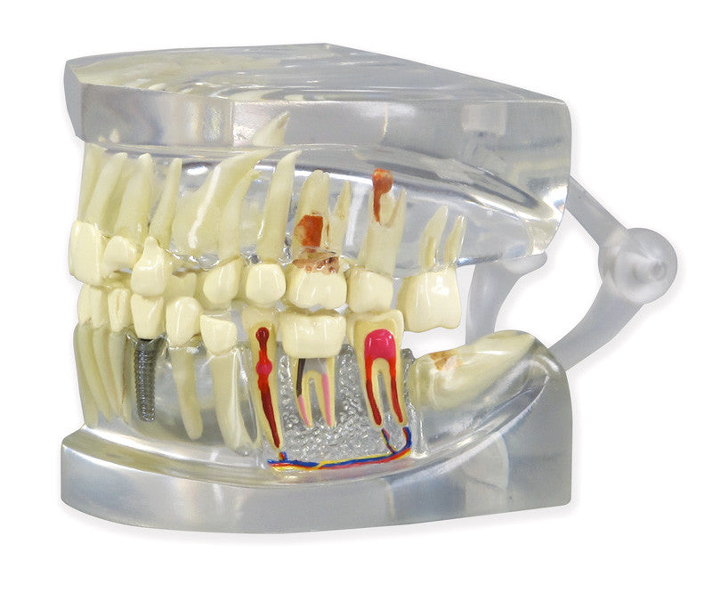 2861_clear-human-jaw-with-t__07477.1589753212.1280.1280.jpg