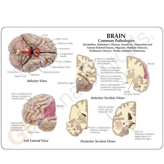 2900-brain-model-rear__70449.1589753350.1280.1280.jpg