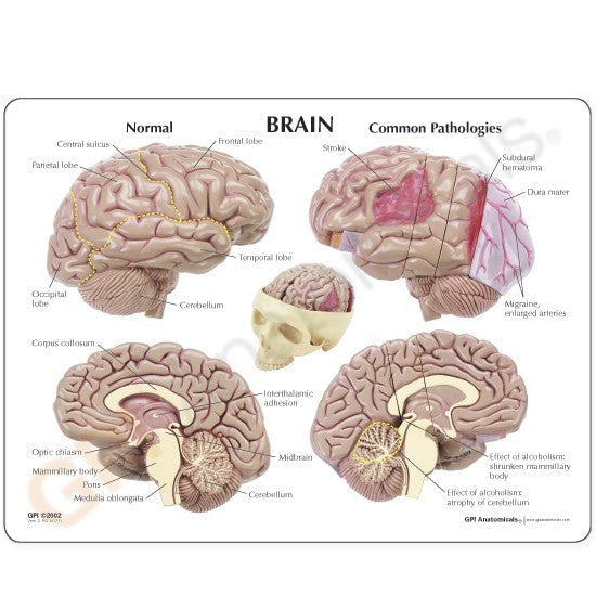 2900-brain-model__84140.1589753349.1280.1280.jpg