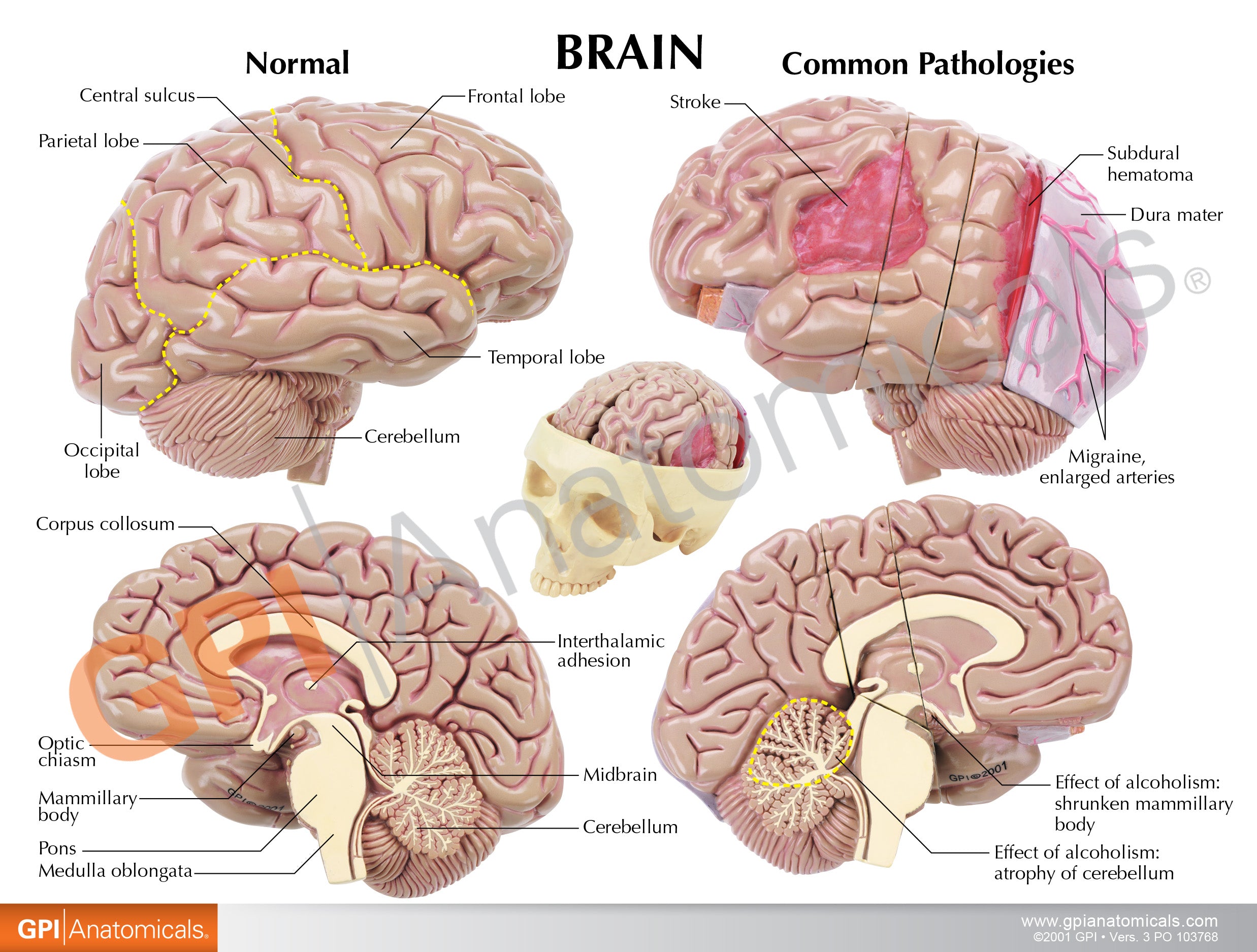 Brain in Base of Skull