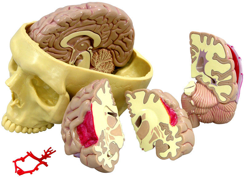 2900_brain__07388.1589753349.1280.1280.jpg