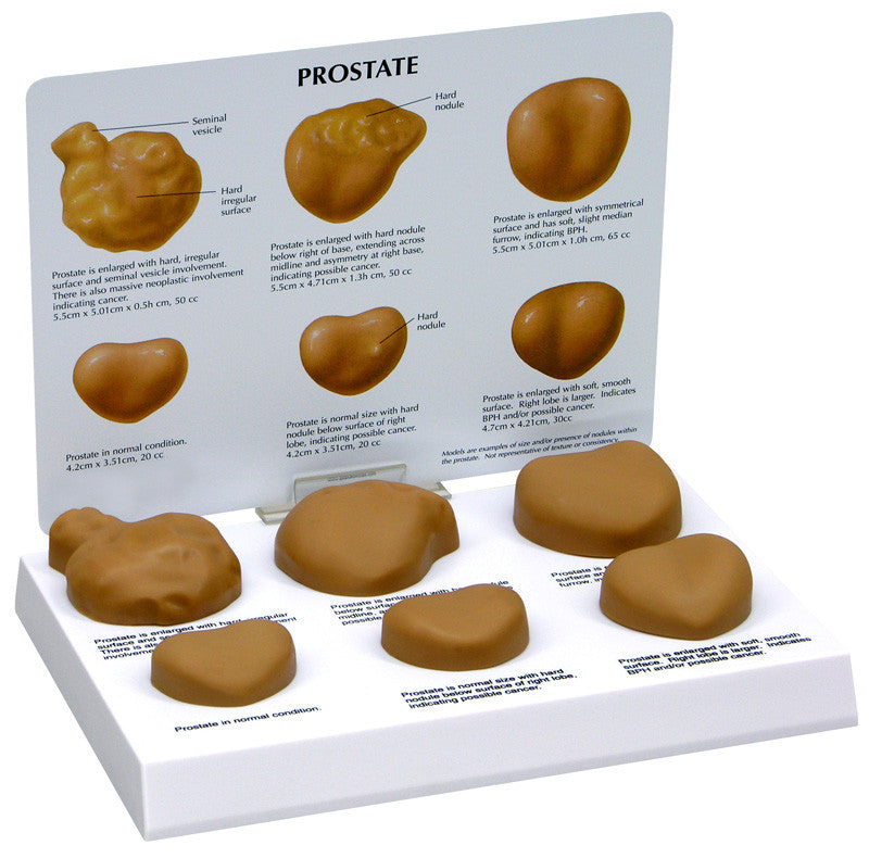 3000_prostate__35835.1589753009.1280.1280.jpg