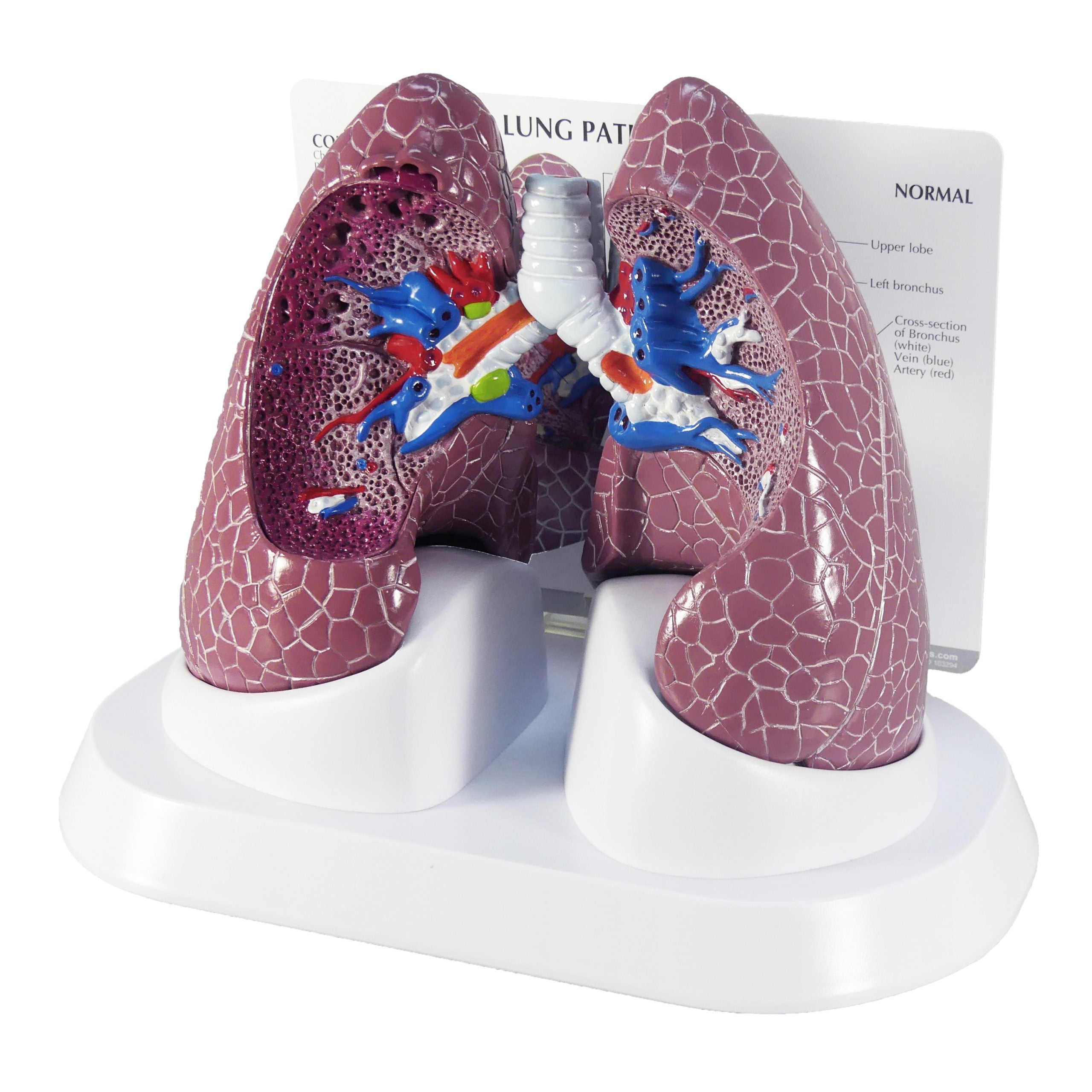 Lung Set (with Pathologies)