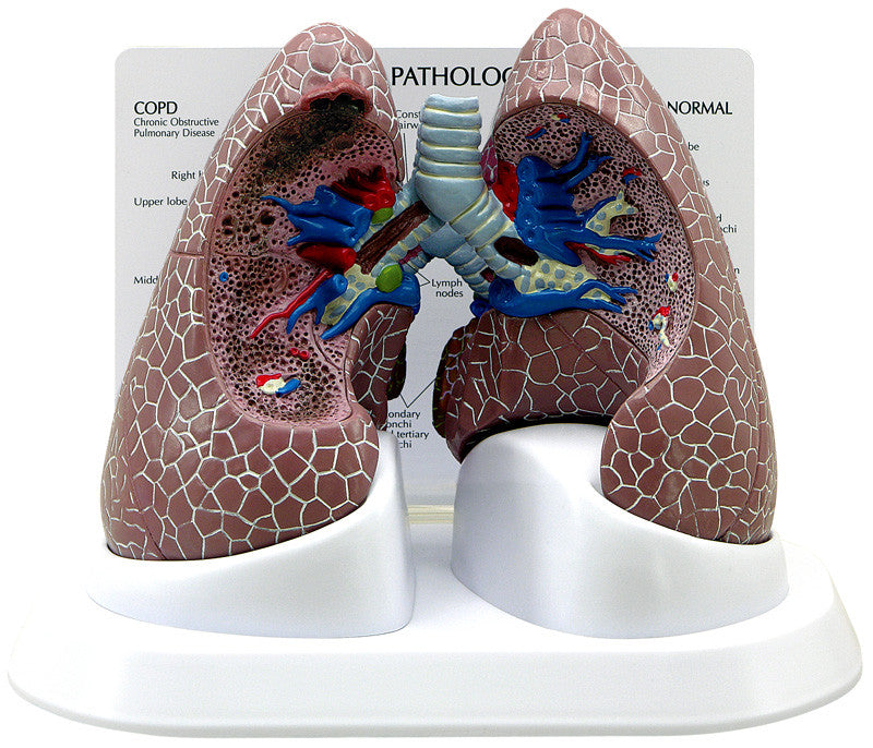 3110_lung_front__88861.1589753072.1280.1280.jpg
