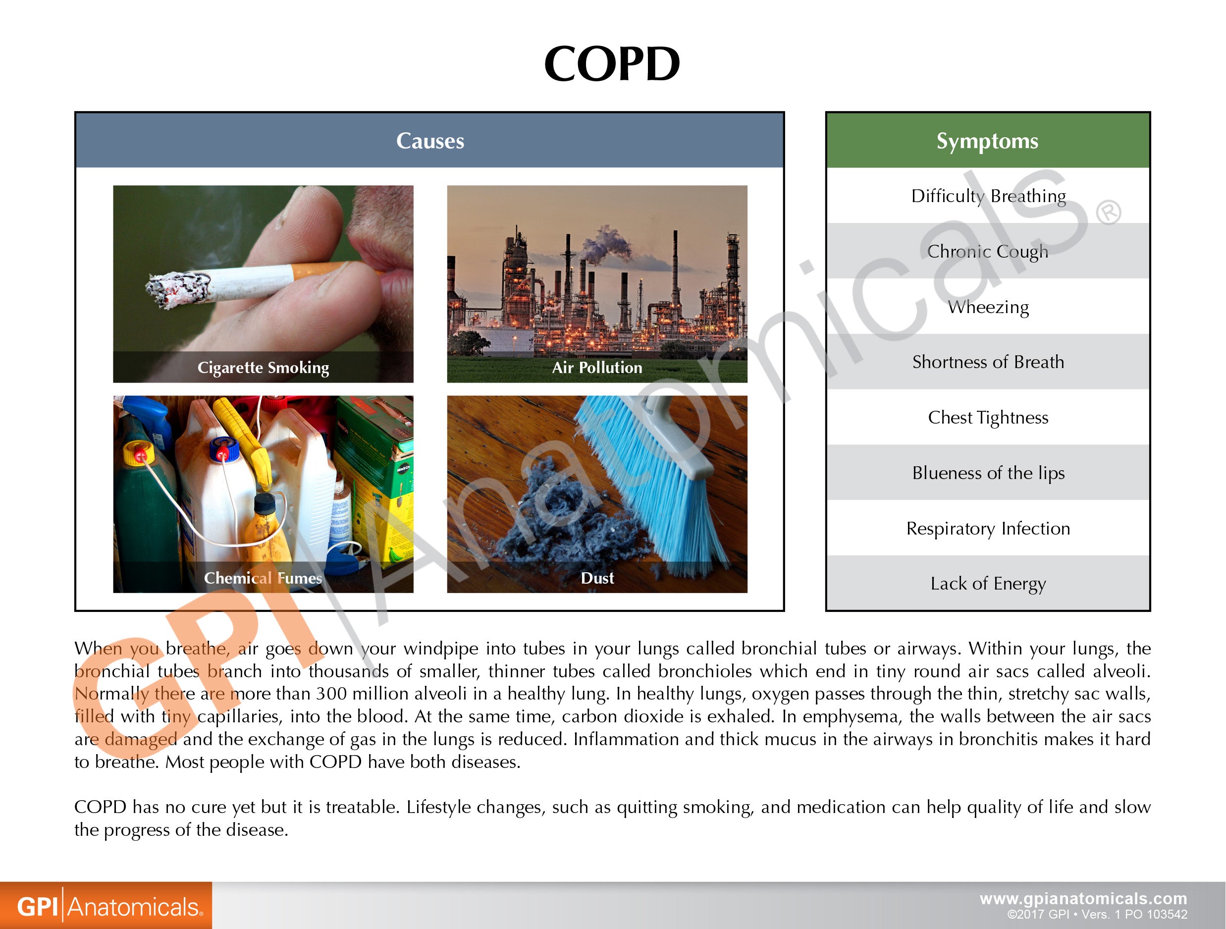 COPD (Bronchus/Aveoli)