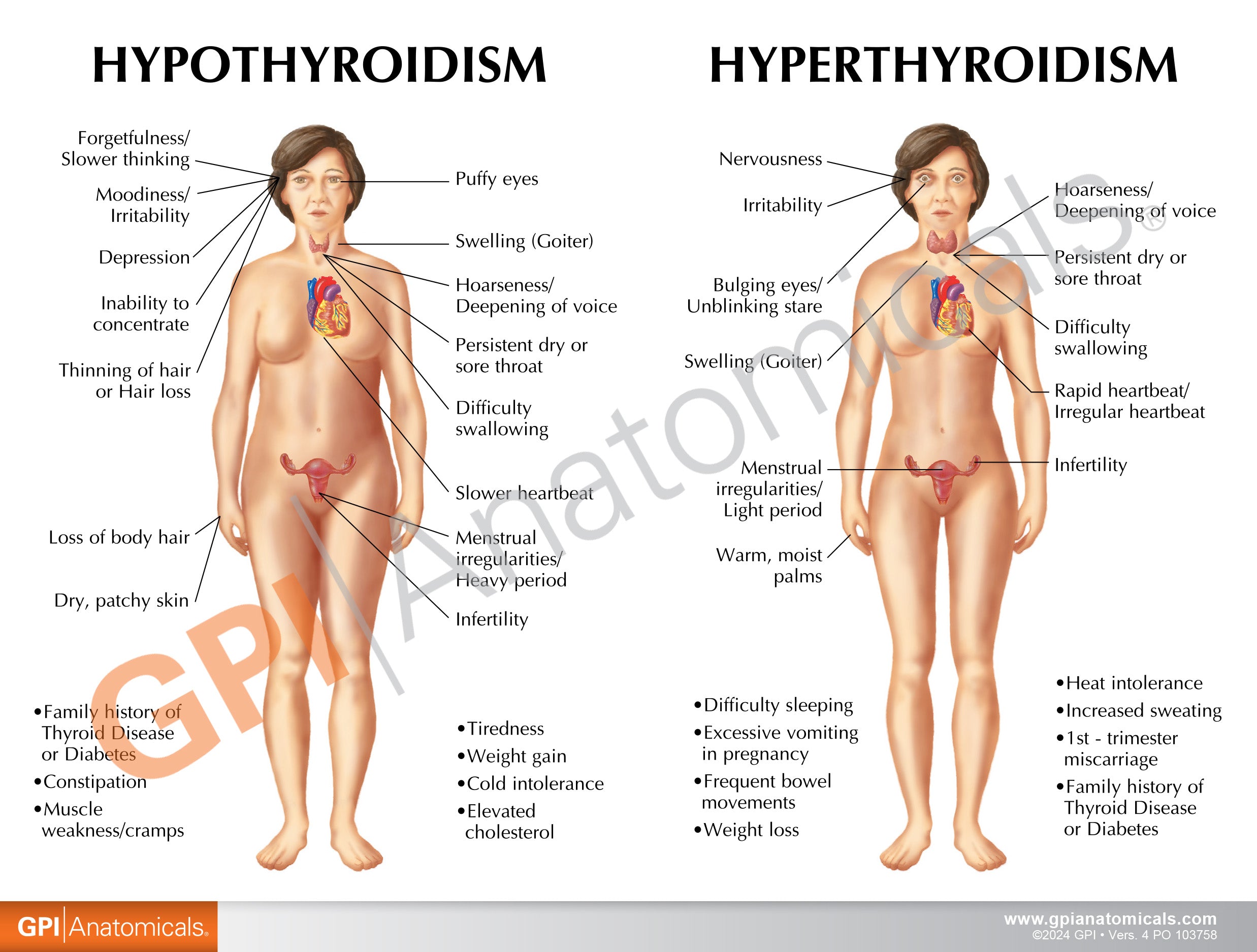 Thyroid
