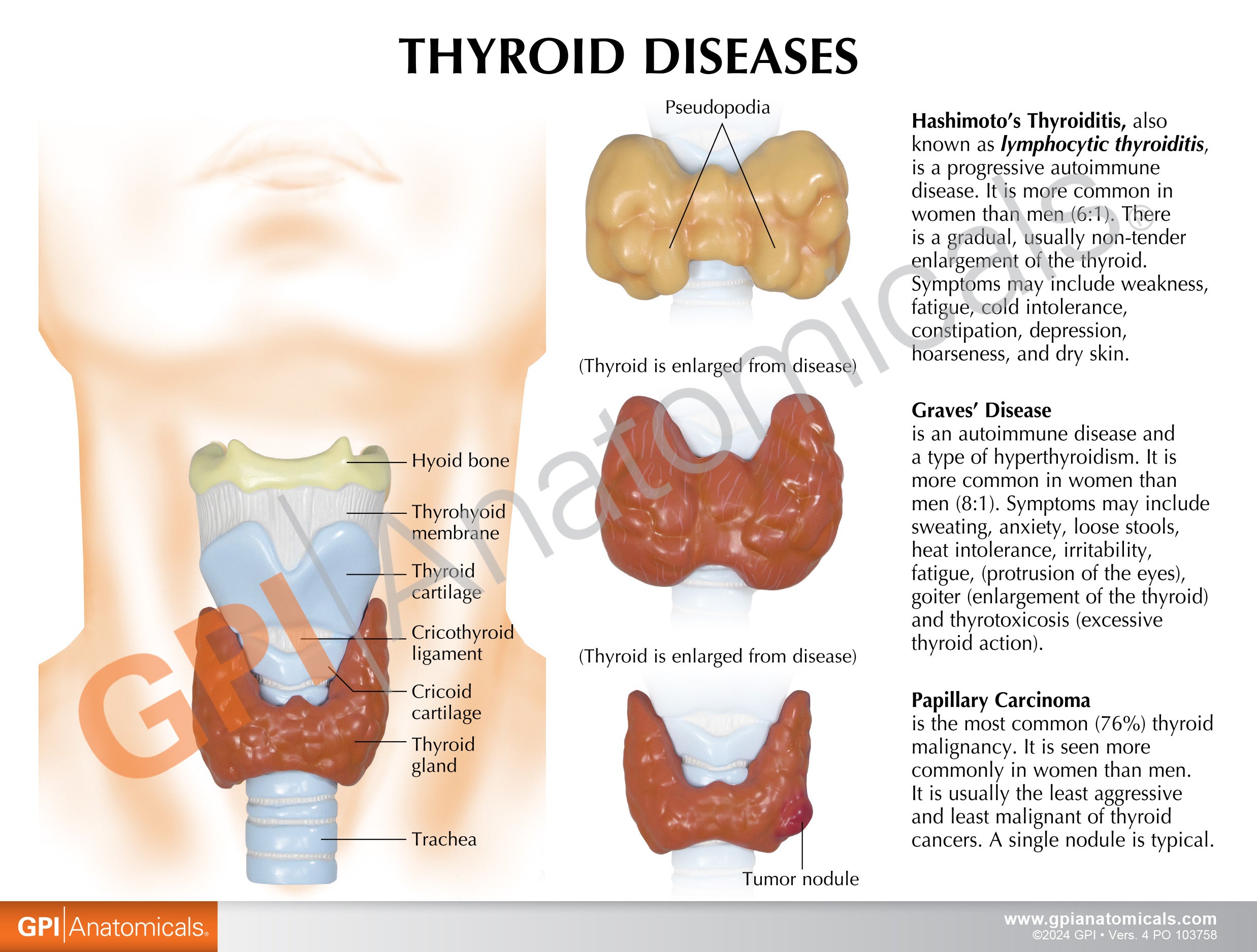 Thyroid