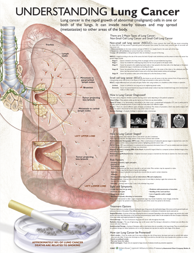3232-und-lung__22895.1589753274.1280.1280.png