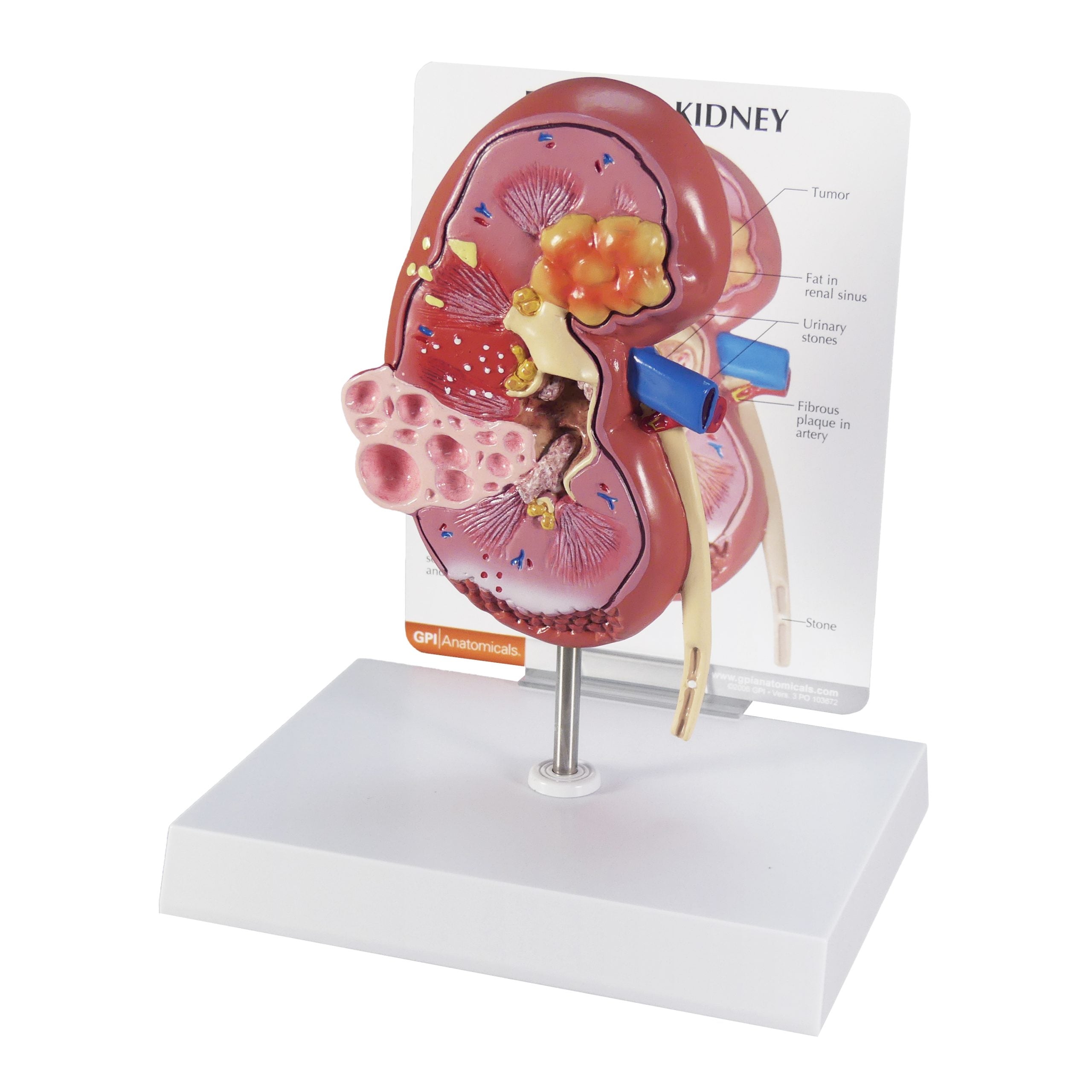 Kidney (Normal/Pathologies)