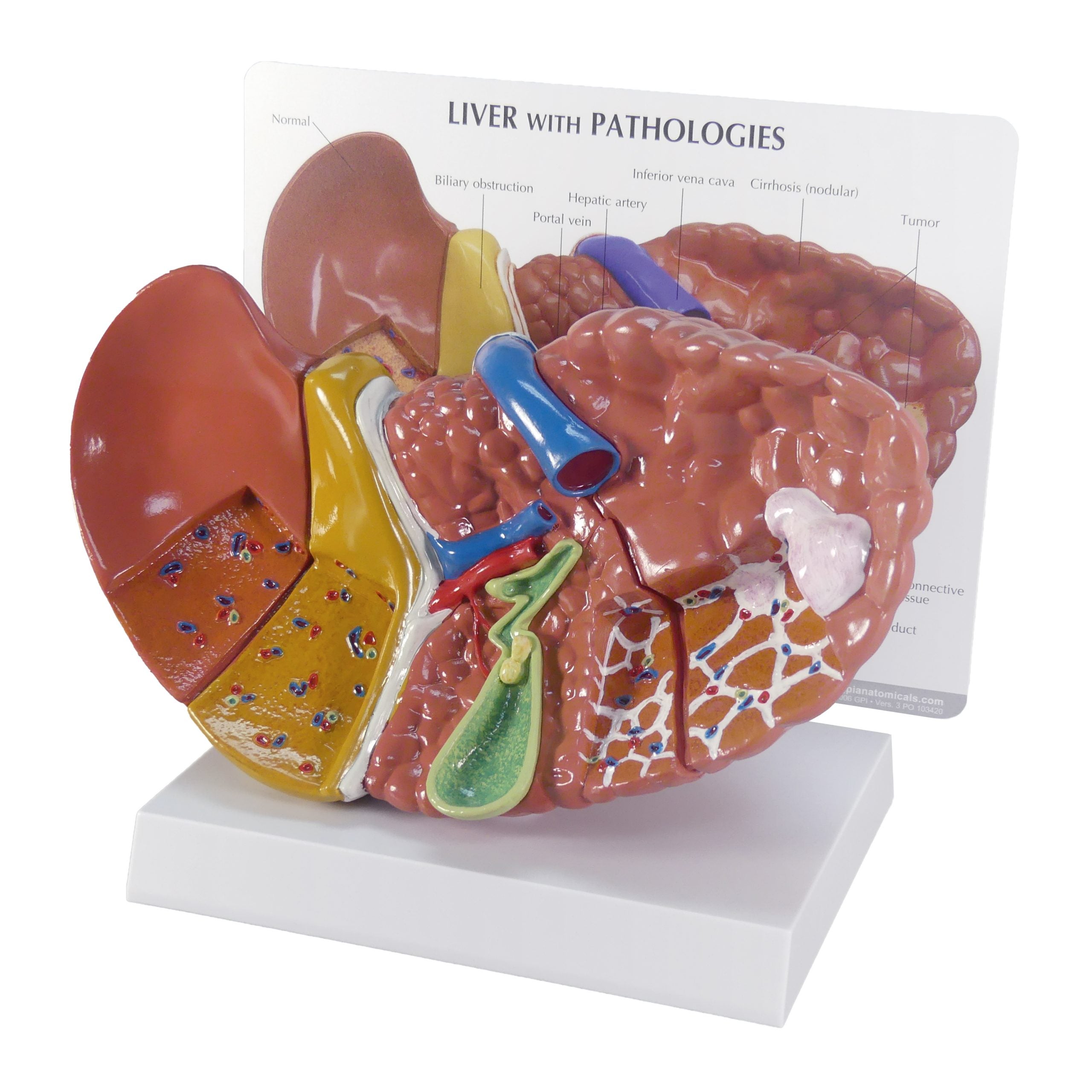 Liver (with Pathologies)