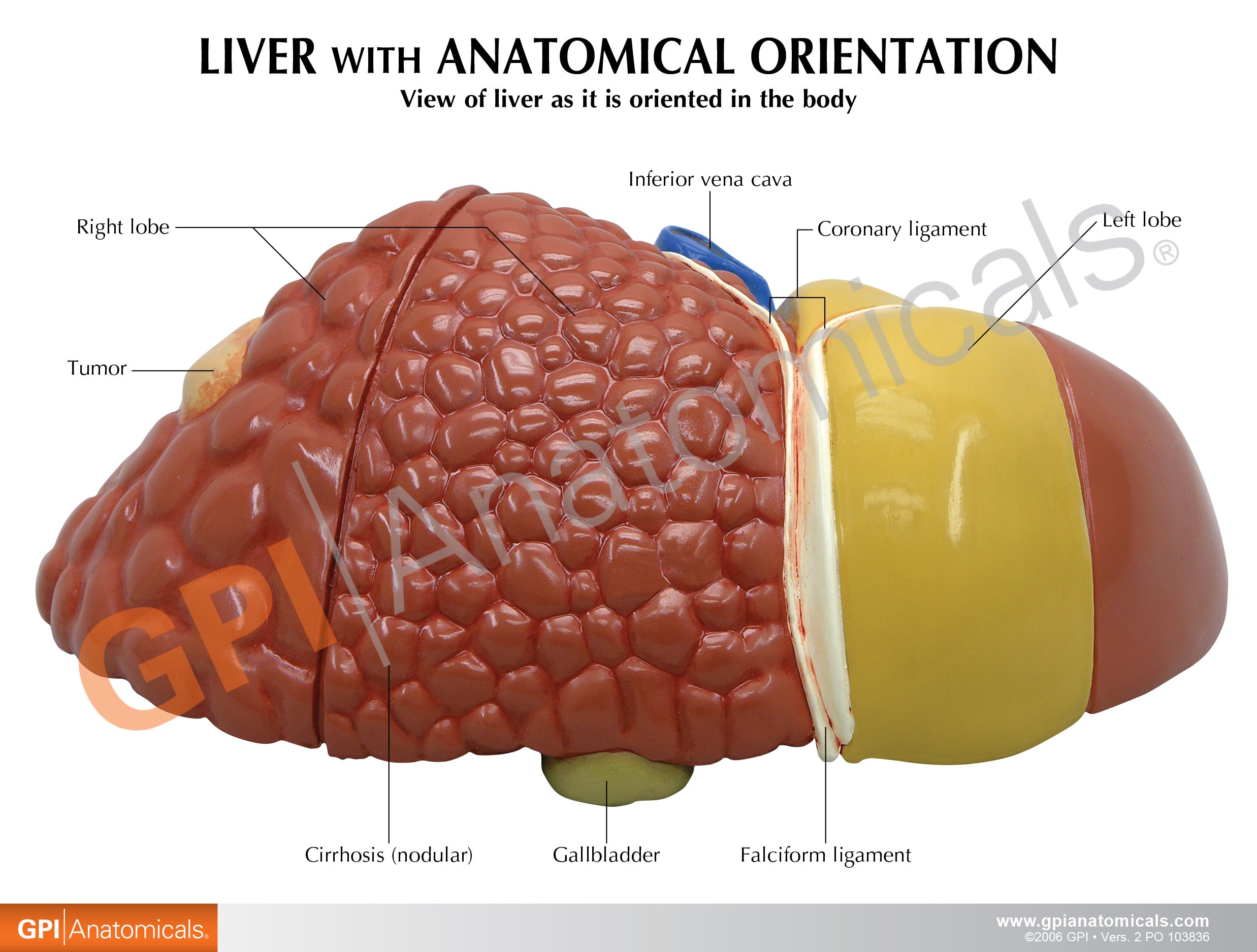 Liver (with Pathologies)