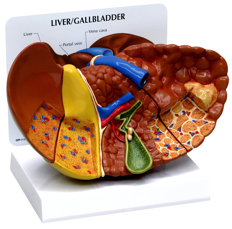 3310_liver_pathologies__72062.1589753302.1280.1280.jpg