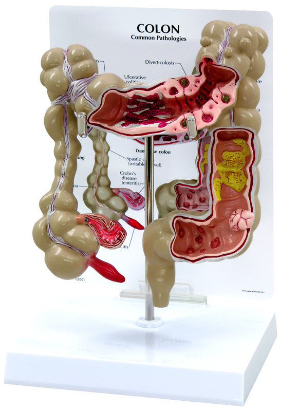 3340_colon__44295.1589753036.1280.1280.jpg