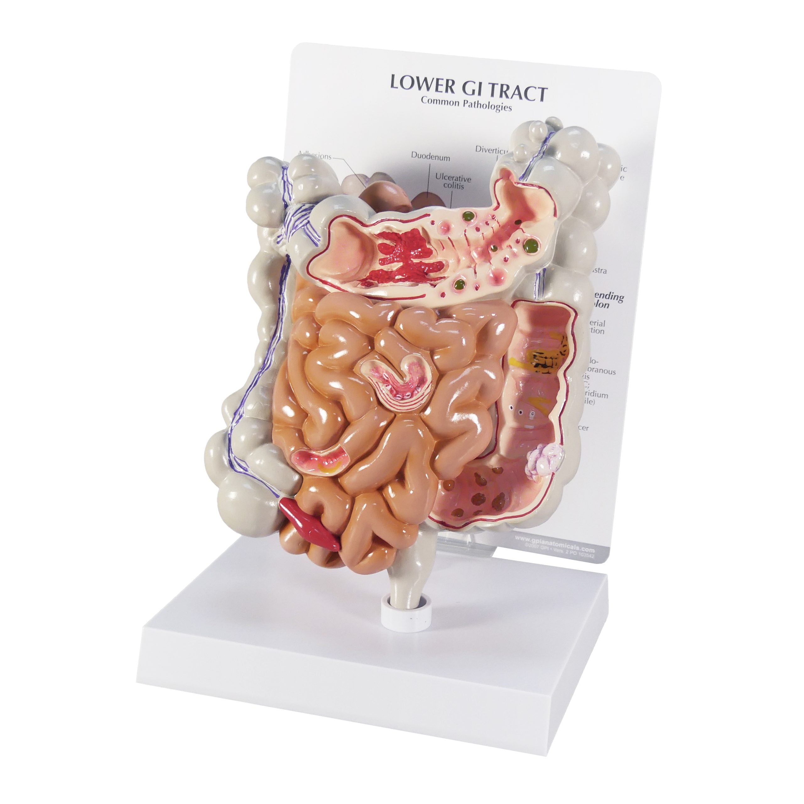 GI Tract