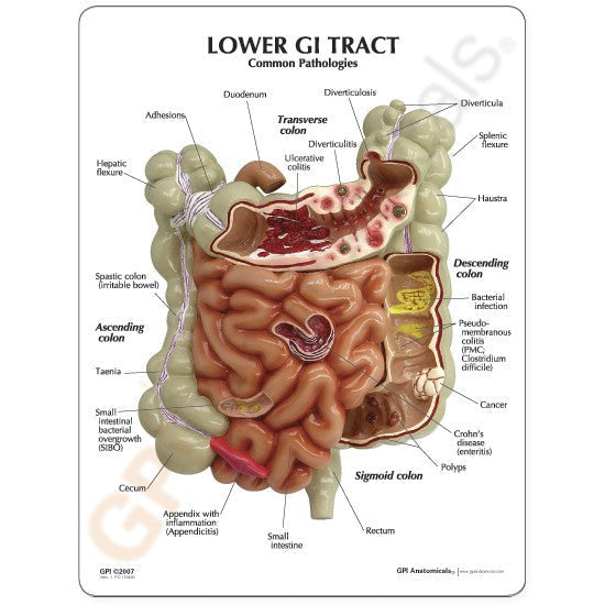 3342-lower-gi-tract__11202.1589753065.1280.1280.jpg