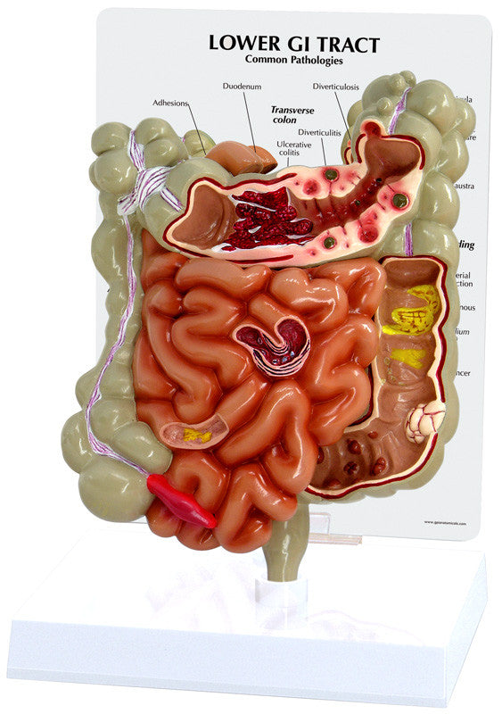 3342_colon_gi_tract__03079.1589753065.1280.1280.jpg