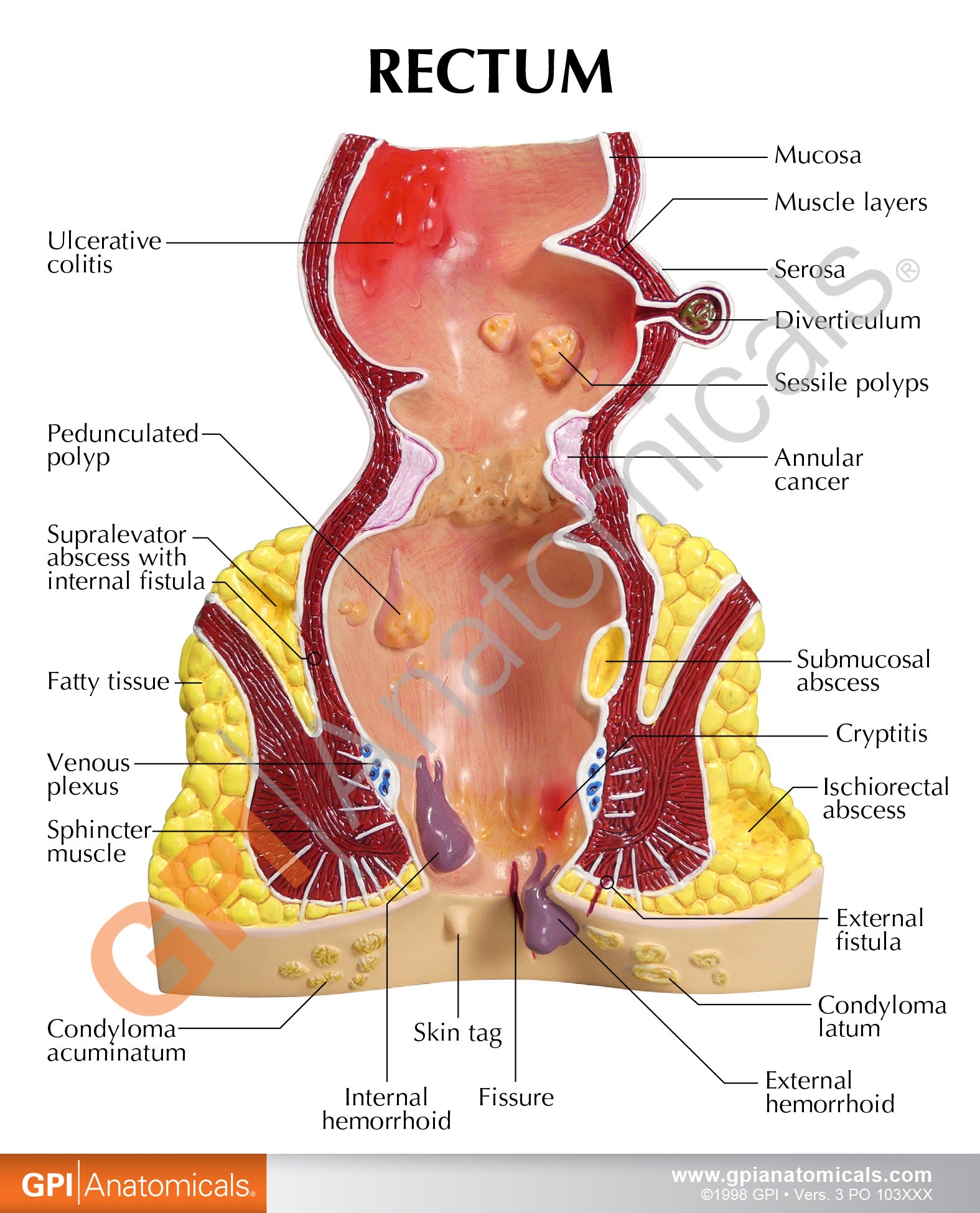 Rectum