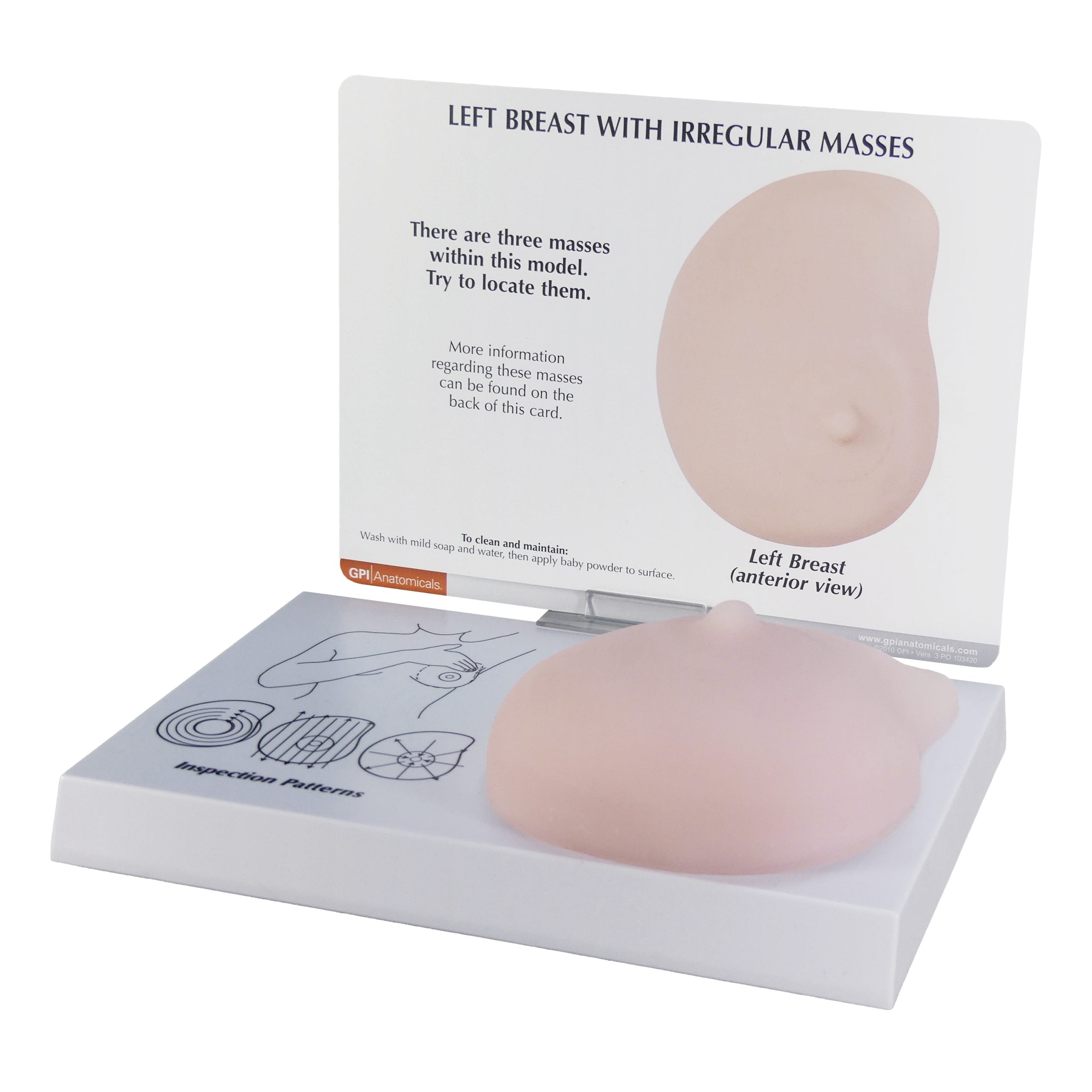 Left Breast (with Irregular Masses)