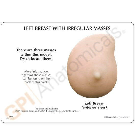 3401-breast-cancer__11713.1589753055.1280.1280.jpg