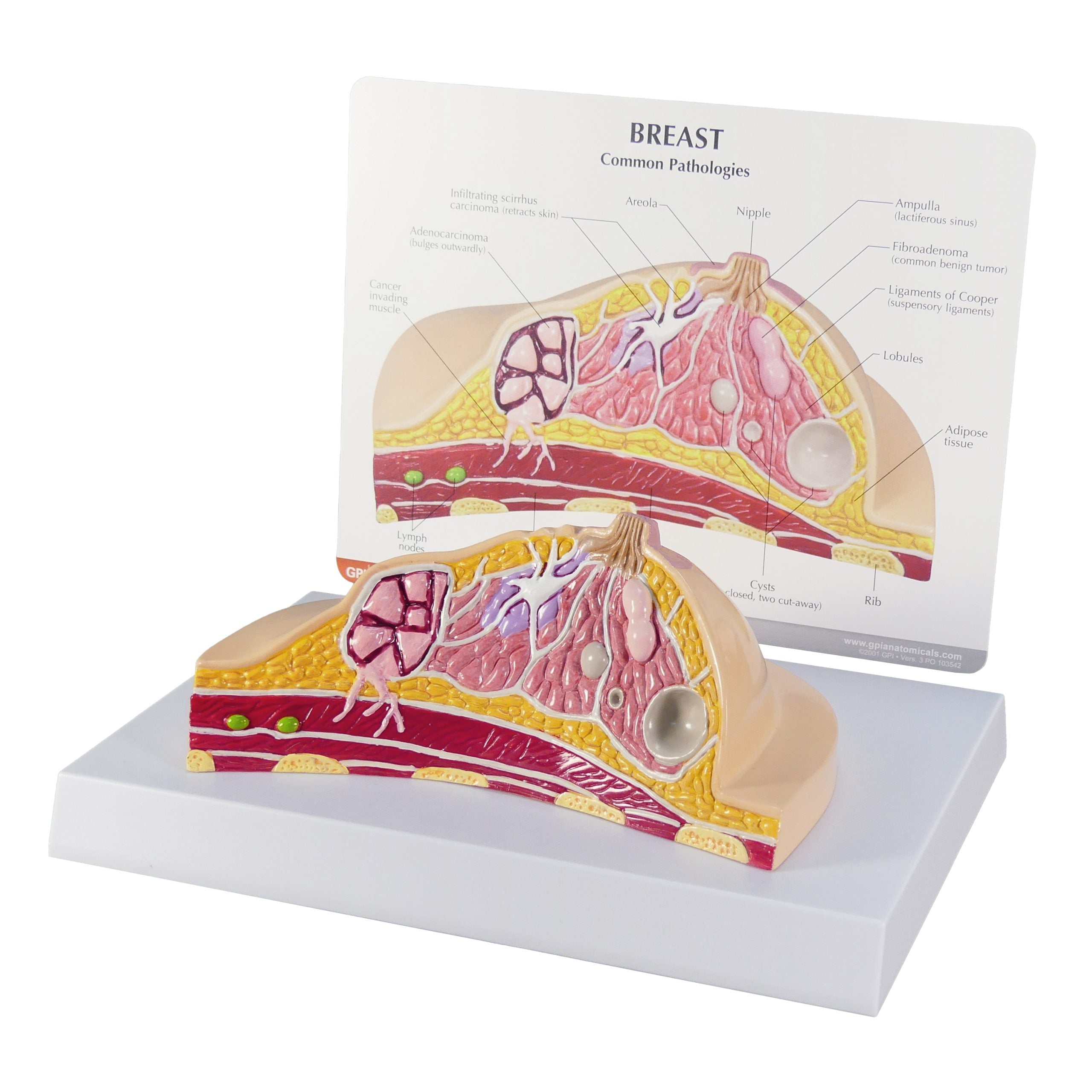 Breast Cross-Section