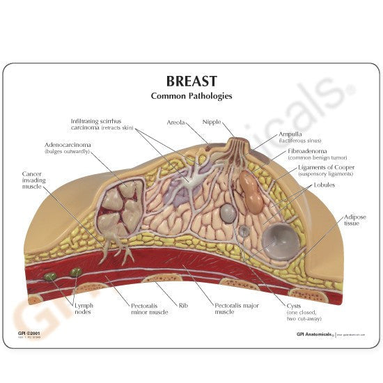 3450-breast__59345.1589753445.1280.1280.jpg