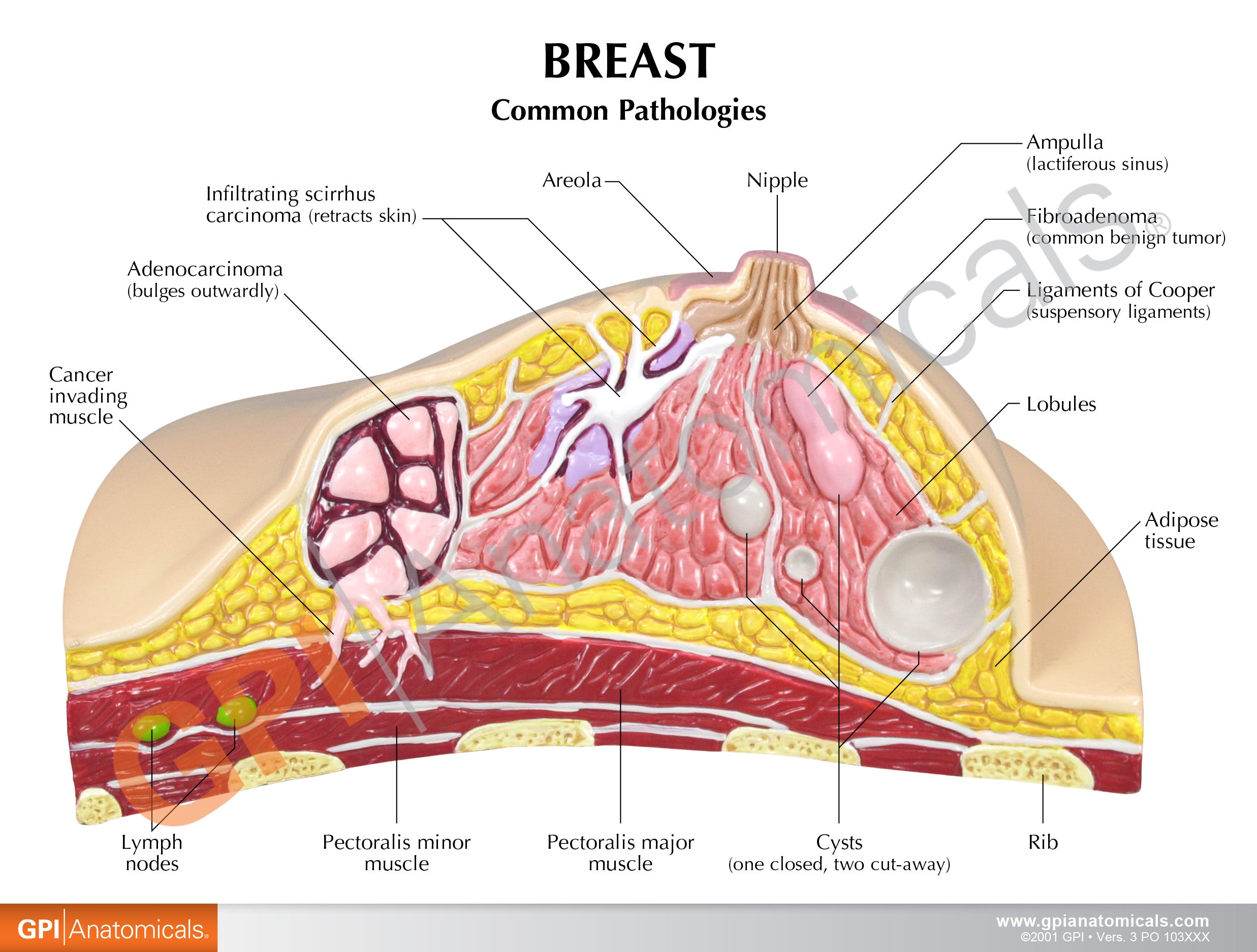 Breast Cross-Section