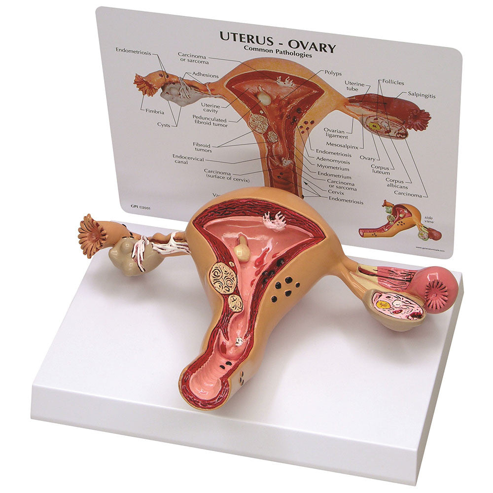 3480-uterus-ovary__42253.1589752941.1280.1280.jpg
