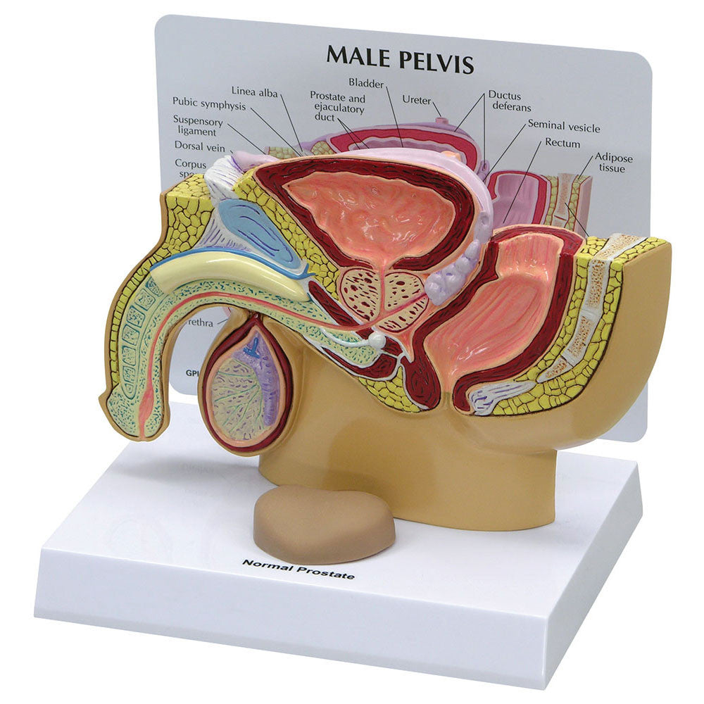 3550_prostate__46582.1589753154.1280.1280.jpg