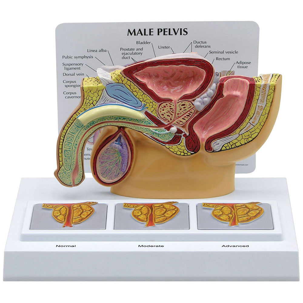3551_pelvis_prostate__70368.1589753167.1280.1280.jpg