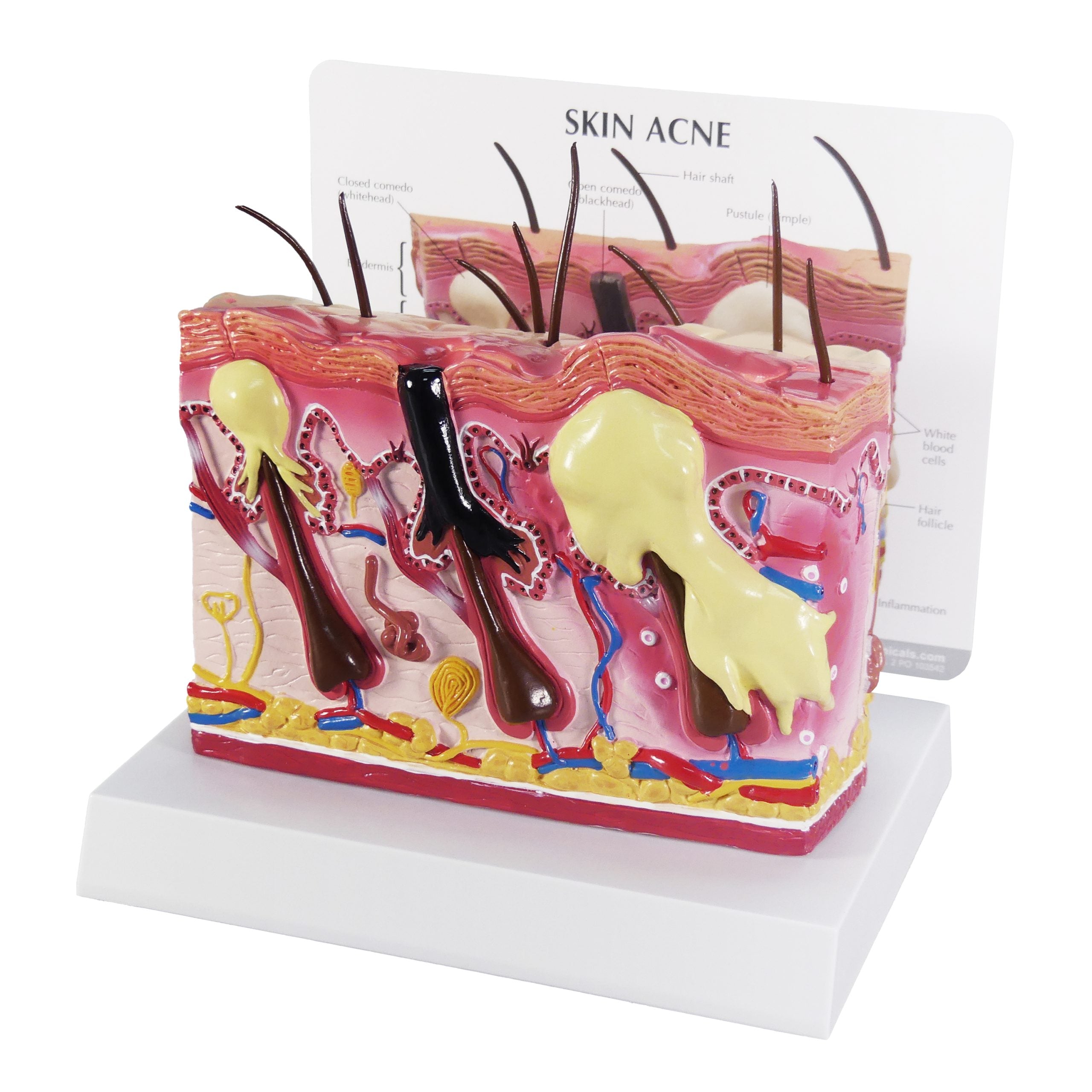 Skin Acne & Normal Skin (2-Sided)