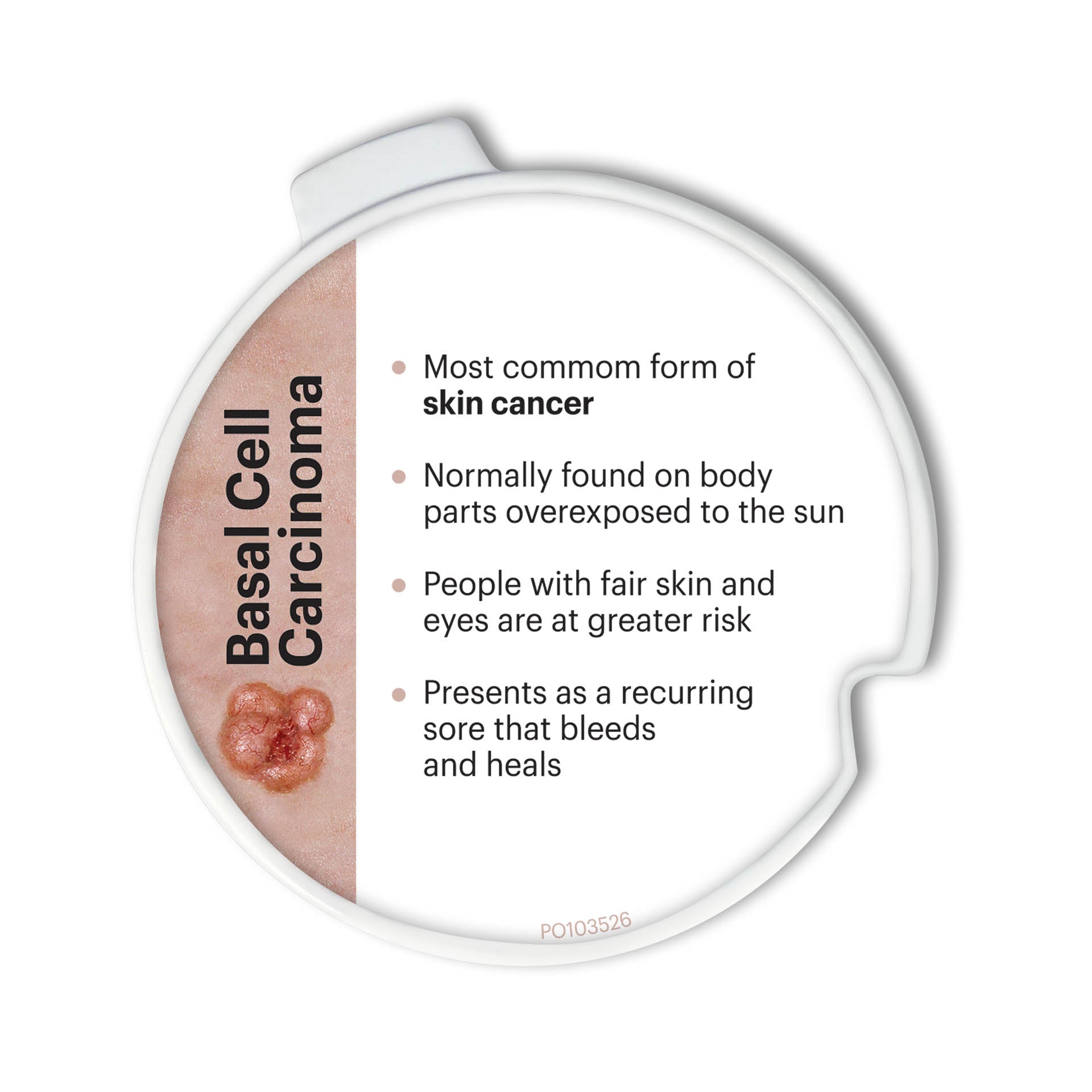 Precancerous & Cancerous Skin Lesions Hinged Disk Set