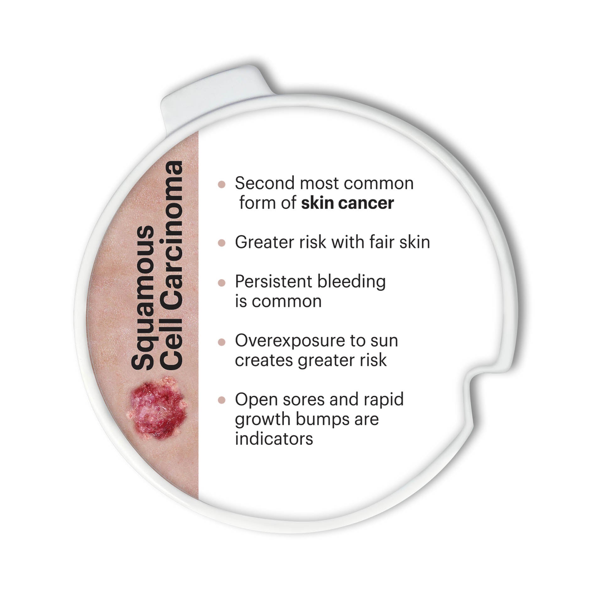 Precancerous & Cancerous Skin Lesions Hinged Disk Set