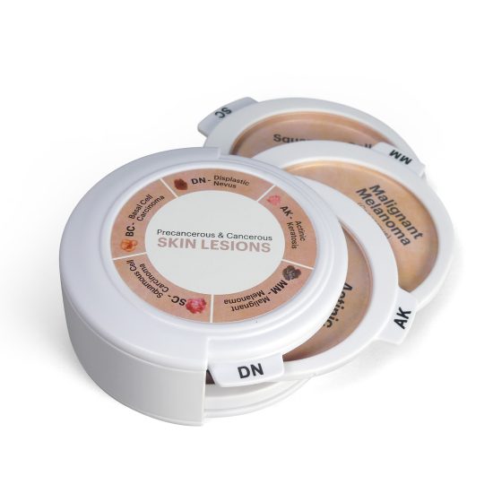 Precancerous & Cancerous Skin Lesions Hinged Disk Set