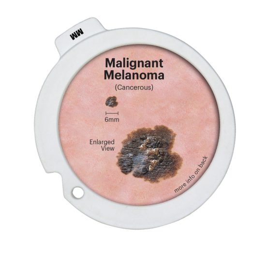 Precancerous & Cancerous Skin Lesions Hinged Disk Set